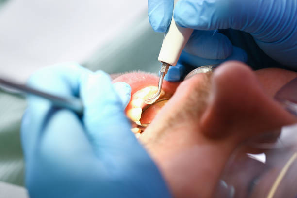 Best Emergency Dental Extractions in Gardende, AL