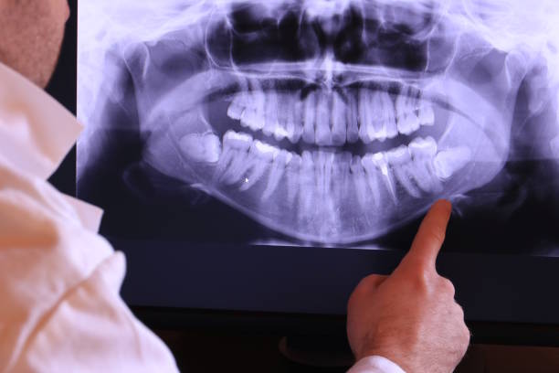Best Emergency Dentist for Knocked-Out Tooth in Gardende, AL